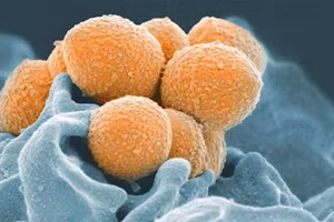 HMO trong sữa mẹ có thể ngừa nhiễm trùng.