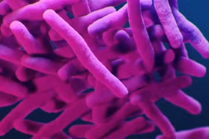 Xuất hiện bệnh lao phổi bất thường tại Mỹ do sản phẩm FiberCel