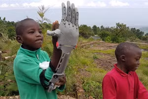 Tay giả do Guillermo Martinez tạo ra có thể nâng 10kg.