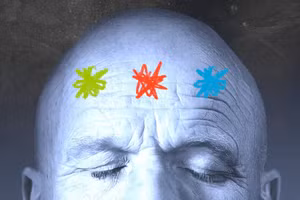 Đau đầu hay nhức đầu là tình trạng rất phổ biến, có thể gặp phải ở bất cứ nhóm tuổi nào. Ảnh minh họa: INT