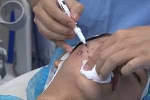 Một số cơ sở thẩm mỹ trên địa bàn TPHCM thực hiện không đúng quy định gây ảnh hưởng đến sức khỏe của khách hàng, thậm chí tử vong.