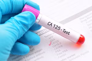 Nghiên cứu thành công kit chẩn đoán ung thư buồng trứng giúp hạ giá thành sản phẩm, để nhiều người được tiếp cận, phát hiện sớm ung thư.