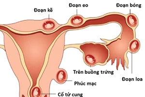 Ảnh minh họa: ITN