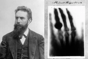 Wilhelm Conrad Röntgen (1845 – 1923) và tấm ảnh X quang đầu tiên của nhân loại.