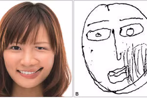 Người mắc PMO nhìn thấy những biến dạng khác nhau.