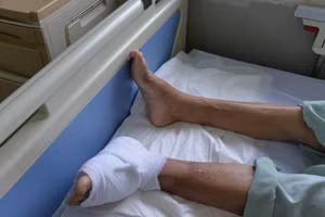 Với người bệnh đái tháo đường, biến chứng loét chân là nguyên nhân hàng đầu gây cắt cụt chi không phải do chấn thương. Ảnh: BV Nội tiết Trung ương