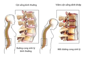 Minh họa/INT