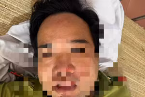 Ông Lê Duy Cường bị thương. (Ảnh: Hạt Kiểm lâm Mường Lát cung cấp)