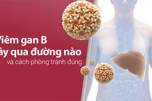 Viêm gan B lây qua đường nào và cách phòng tránh đúng?