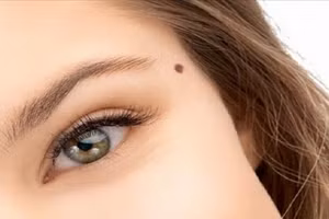 Những vị trí nốt ruồi chứng tỏ bạn thông minh, tài giỏi hơn người