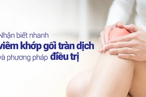 Nhận biết nhanh viêm khớp gối tràn dịch có ý nghĩa quan trọng.