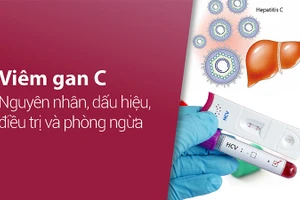 Viêm gan C dễ dẫn đến viêm gan mạn tính, xơ gan và ung thư gan 