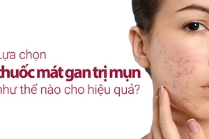 Mụn có thể do các vấn đề về gan gây nên.