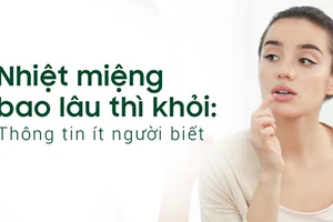 Nhiệt miệng bao lâu thì khỏi là thắc mắc của nhiều người