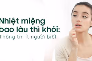 Nhiệt miệng bao lâu thì khỏi là thắc mắc của nhiều người