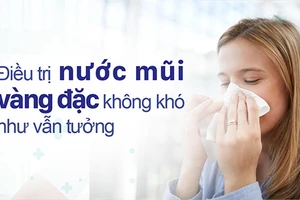 Có nhiều cách điều trị nước mũi vàng đặc mà không cần dùng thuốc kháng sinh.