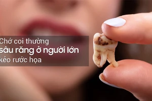 Sâu răng ở người lớn có thể dẫn đến những hậu quả nghiêm trọng