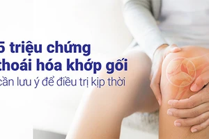 Nhận biết các triệu chứng thoái hoá khớp gối có ý nghĩa rất quan trọng.