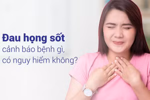 Có rất nhiều căn bệnh có triệu chứng đau họng sốt