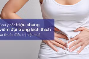 Nhận biết sớm triệu chứng đại tràng kích thích sẽ giúp bạn có phương pháp điều trị kịp thời