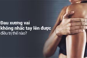 Đau xương vai, đau khớp vai có thể do rất nhiều nguyên nhân.