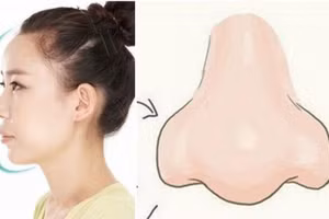 3 tướng mũi phú quý "nghìn người có 1", dù là đàn ông hay phụ nữ đều hưởng số phát tài