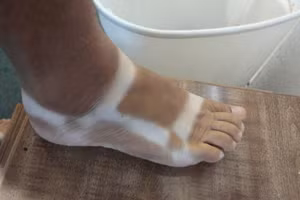 Mùa hè... dữ dội