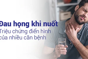 Đau họng khi nuốt là triệu chứng của nhiều căn bệnh 