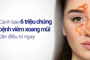 Nhận biết triệu chứng bệnh viêm xoang mũi giúp điều trị chính xác.