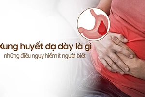 Tìm hiểu xung huyết dạ dày là gì và cách khắc phục