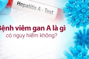 Bệnh viêm gan A là bệnh có thể hồi phục hoàn toàn. 