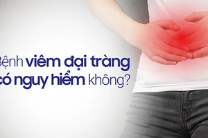 Chuyên gia giải đáp "Bệnh viêm đại tràng có nguy hiểm không?"