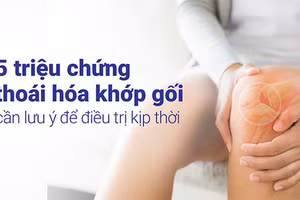 Nhận biết các triệu chứng thoái hoá khớp gối có ý nghĩa rất quan trọng.