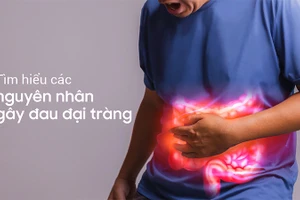 Đau đại tràng do nhiều nguyên nhân gây nên 
