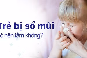 Trẻ bị sổ mũi có nên tắm không là thắc mắc của nhiều người.