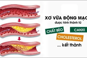 Ăn thêm choline có thể giúp giảm nguy cơ mắc bệnh tim mạch