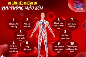 10 dấu hiệu cảnh báo tuần hoàn máu kém và lời khuyên để cải thiện lưu thông máu