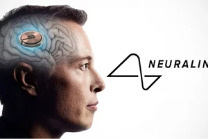 Tỷ phú Elon Musk vui mừng tin công ty Neuralink được cấp phép cấy chip vào não người.