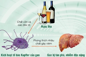 Những bệnh lý về gan nguy hiểm nhất bắt nguồn từ thói quen bia rượu