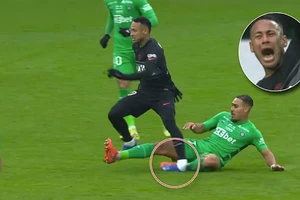 Neymar chấn thương sốc khi gập cổ chân trụ 90 độ.