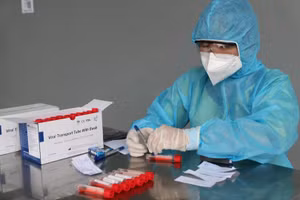 HCDC truy vết lấy mẫu xét nghiệm các trường hợp liên quan đến ca nhiễm Covid-19 để phòng dịch (Ảnh:HCDC)