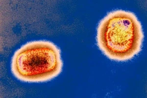 Virus đậu mùa khỉ có khả năng lây qua nhiều đường, thay vì chỉ qua đường máu và các dịch trong quan hệ tình dục.