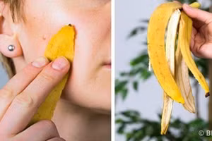 Vỏ chuối có tác dụng làm đẹp da (hình minh họa)