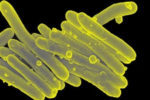 Hình ảnh mô tả vi khuẩn mycobacterium tuberculosis.