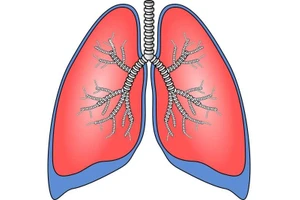 Tiếp xúc với các chất gây ung thư, gây ra đột biến DNA và có thể trở thành ung thư. 