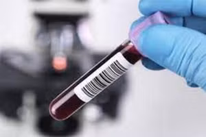 Hiểu đúng về lượng cồn trong máu