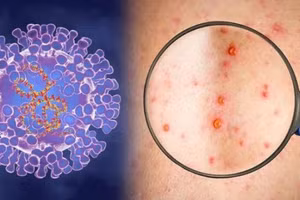 Ảnh minh họa/INT