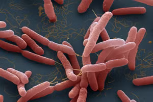 Người nhiễm vi khuẩn "ăn thịt người" thường có biểu hiện sốt cao và đau dạ dày. 