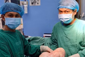 Các bác sỹ đã phẫu thuật, lấy thành công khối u nặng hơn 6kg.