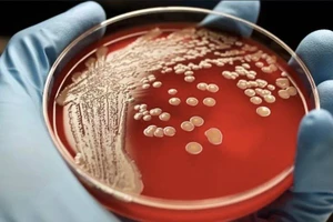 Vi khuẩn Staphylococcus aureus kháng thuốc.
